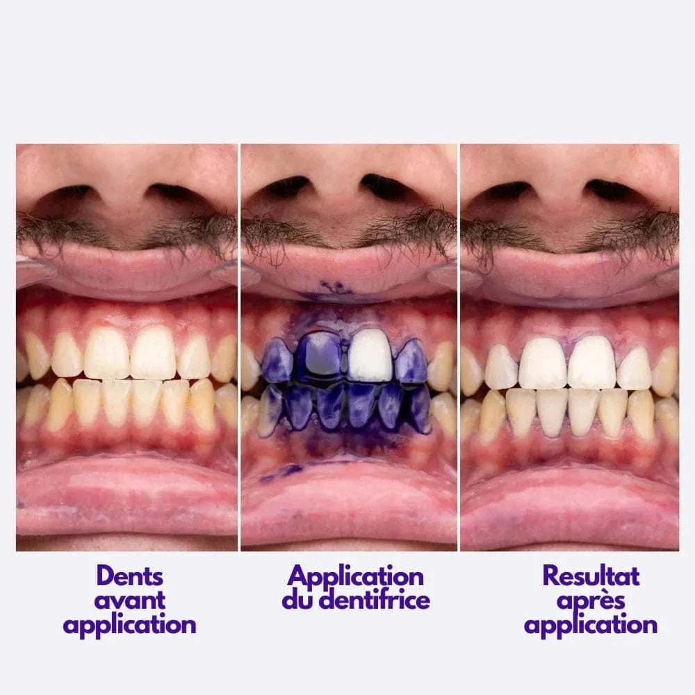 bioland-®-dentifraiche-✨
